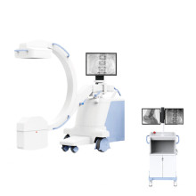 Mobile Digital FPD C-arm System Raidography X ray Lumbar Vertebra Fluoroscopy PLX118F